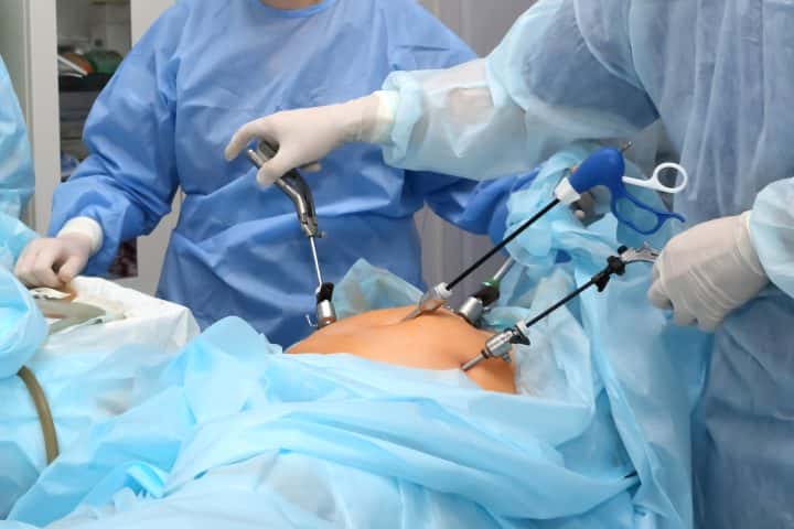 Cirurgia bariátrica Uopeccan