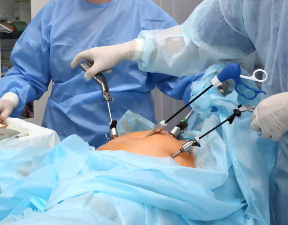 Cirurgia bariátrica Uopeccan